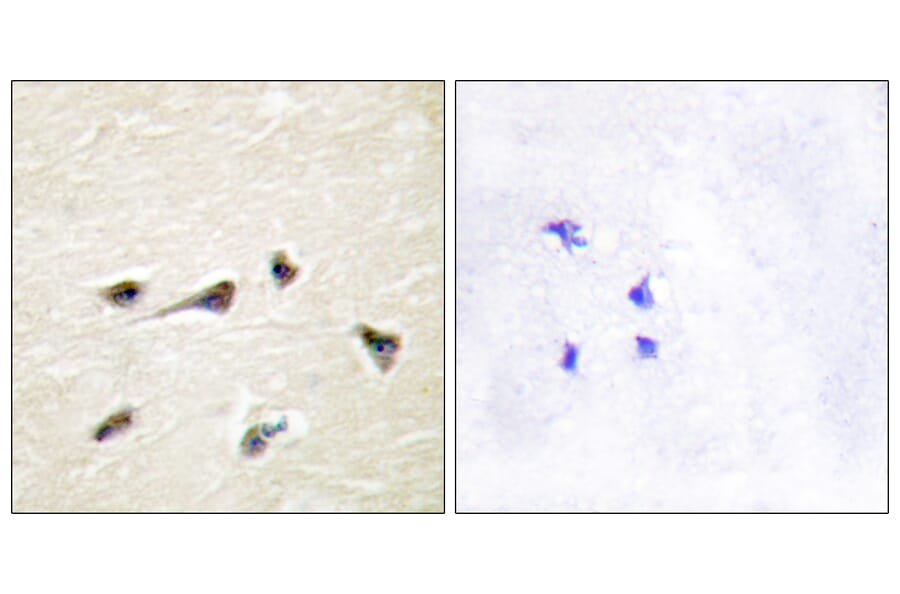 Immunohistochemistry - Anti-AKAP12 Antibody (C10861) - Antibodies.com