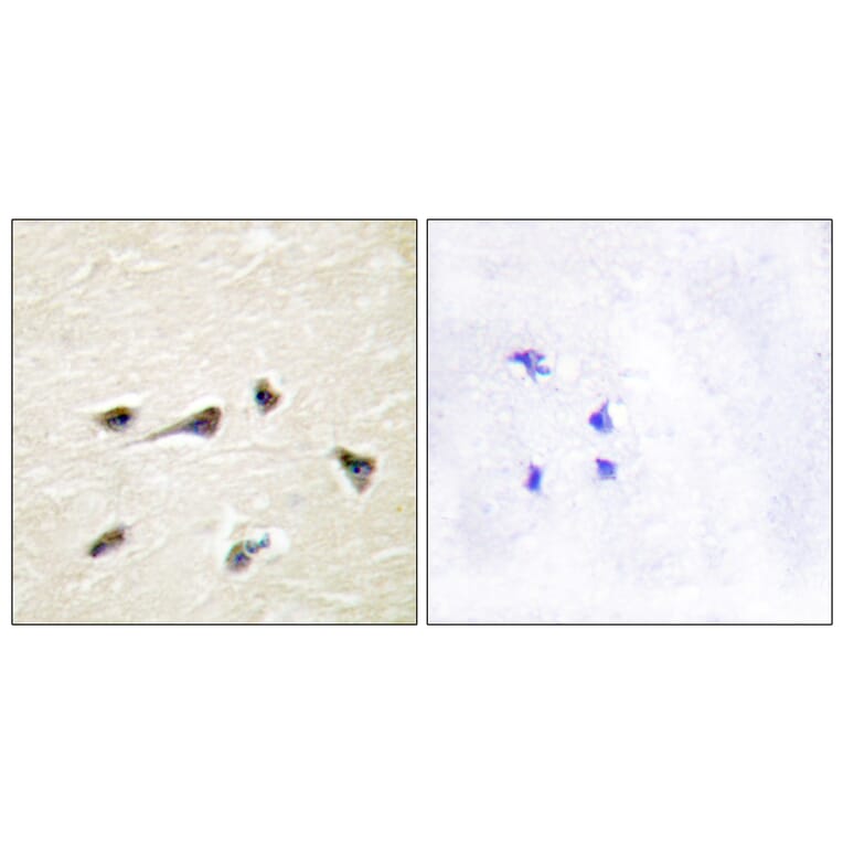 Immunohistochemistry - Anti-AKAP12 Antibody (C10861) - Antibodies.com