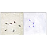 Immunohistochemistry - Anti-AKAP12 Antibody (C10861) - Antibodies.com