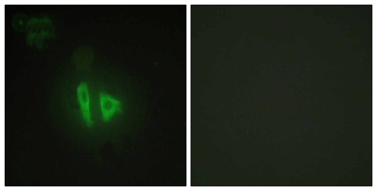 Immunofluorescence analysis of HepG2 cells using Anti-AKAP11 Antibody. The right hand panel represents a negative control, where the antibody was pre-incubated with the immunising peptide.