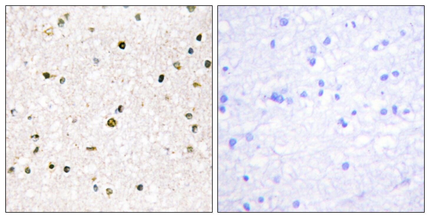 Immunohistochemical analysis of paraffin-embedded human brain tissue using Anti-AKAP11 Antibody. The right hand panel represents a negative control, where the antibody was pre-incubated with the immunising peptide.