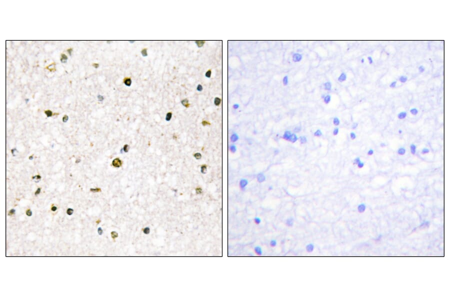 Immunohistochemistry - Anti-AKAP11 Antibody (C11868) - Antibodies.com