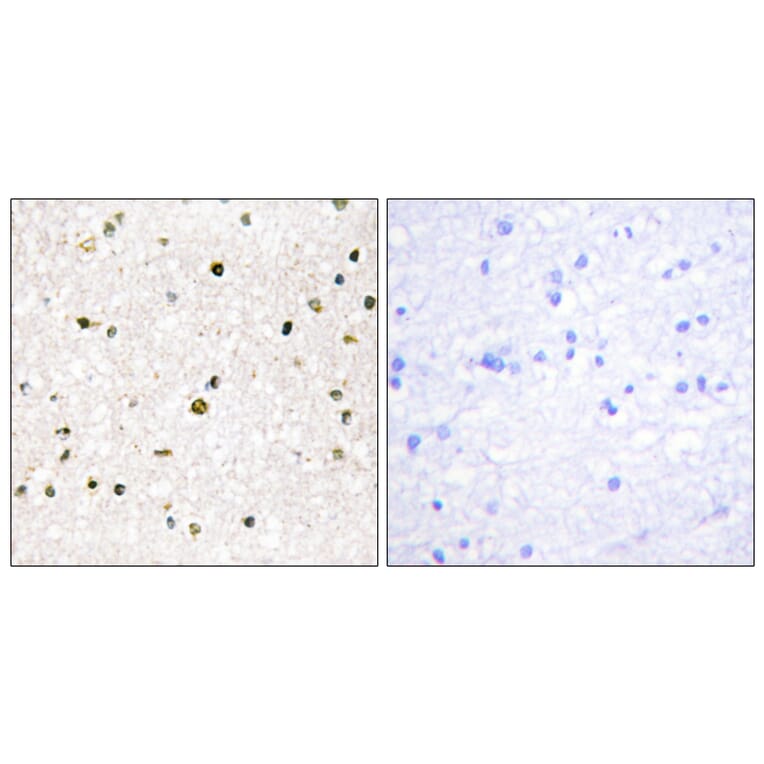 Immunohistochemistry - Anti-AKAP11 Antibody (C11868) - Antibodies.com