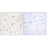 Immunohistochemistry - Anti-AKAP11 Antibody (C11868) - Antibodies.com