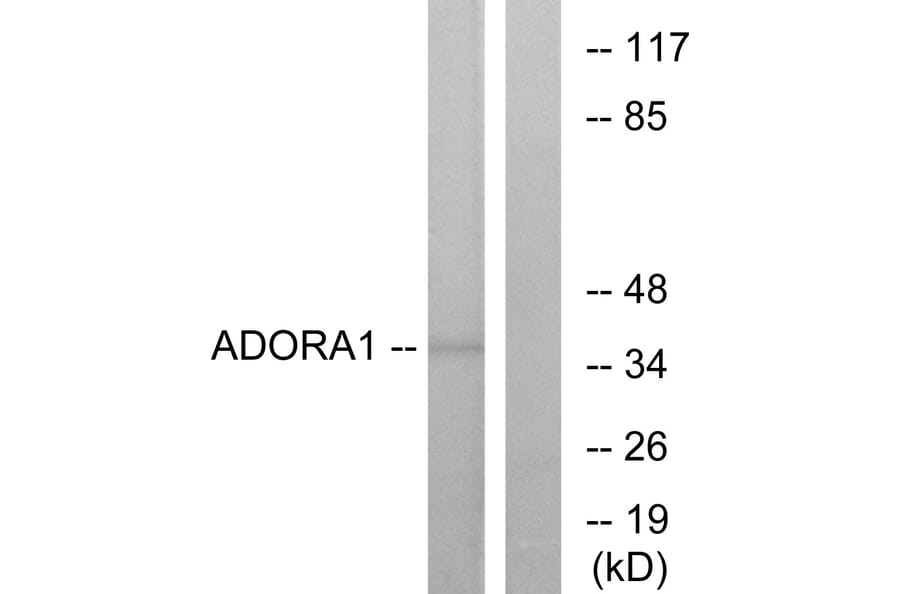 Western Blot - Anti-ADORA1 Antibody (G201) - Antibodies.com