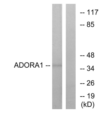 Western Blot - Anti-ADORA1 Antibody (G201) - Antibodies.com