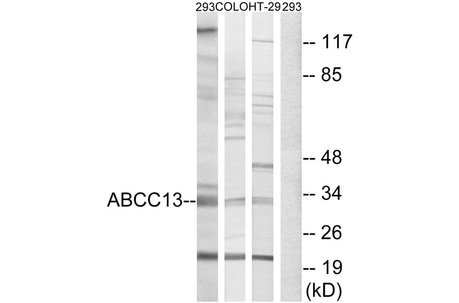 Western Blot - Anti-ABCC13 Antibody (C18078) - Antibodies.com