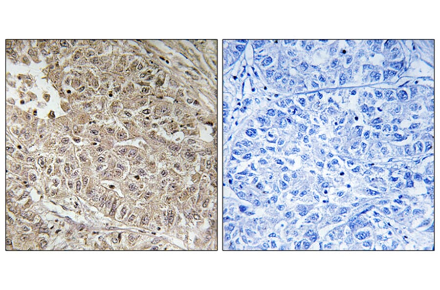 Immunohistochemistry - Anti-ABCC13 Antibody (C18078) - Antibodies.com