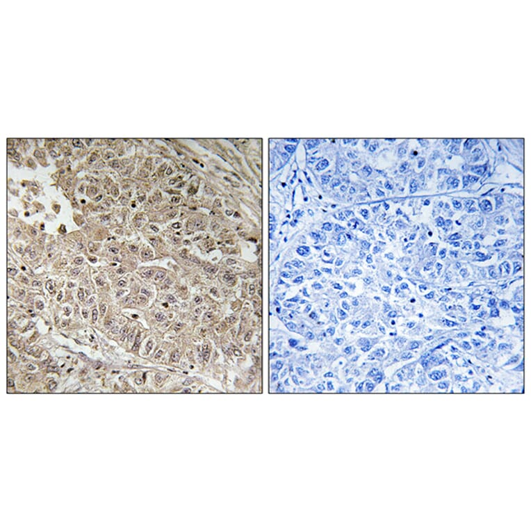 Immunohistochemistry - Anti-ABCC13 Antibody (C18078) - Antibodies.com