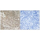 Immunohistochemistry - Anti-ABCC13 Antibody (C18078) - Antibodies.com