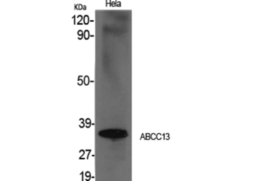 Western Blot - Anti-ABCC13 Antibody (C18078) - Antibodies.com
