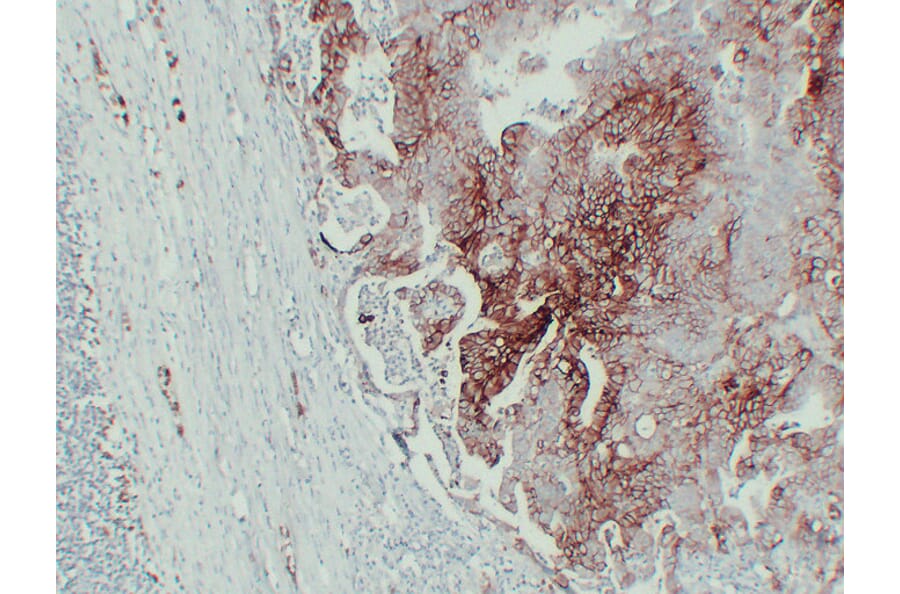 Immunohistochemistry - Anti-GLUT 1 Antibody (V0078) - Antibodies.com