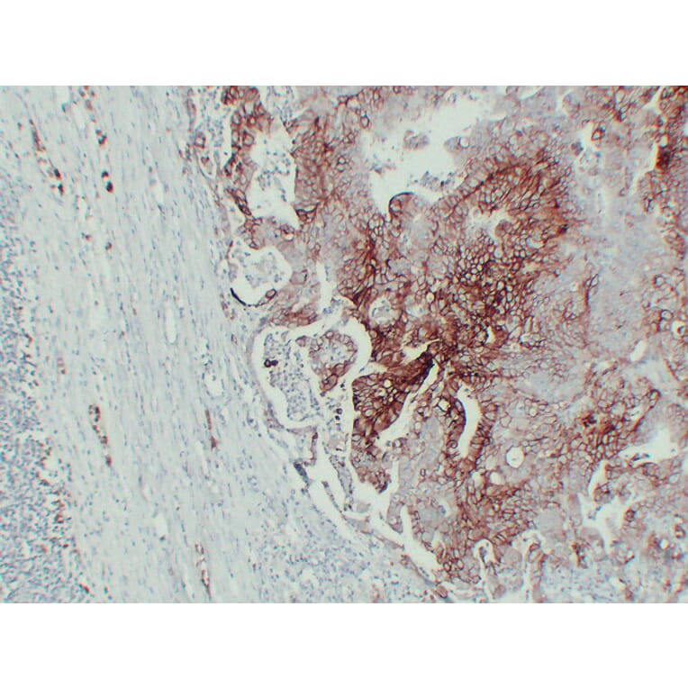 Immunohistochemistry - Anti-GLUT 1 Antibody (V0078) - Antibodies.com