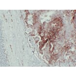 Immunohistochemistry - Anti-GLUT 1 Antibody (V0078) - Antibodies.com