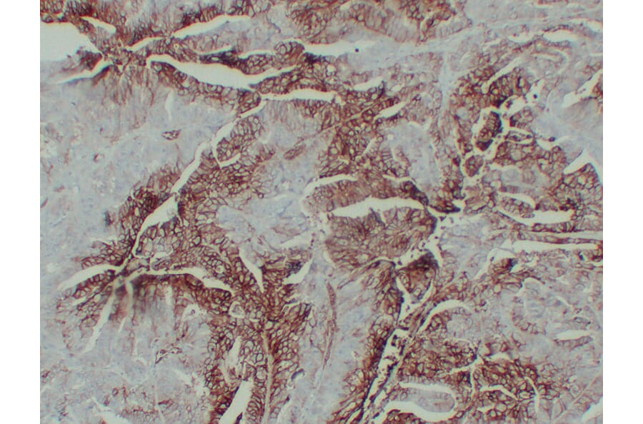 Immunohistochemistry - Anti-GLUT 1 Antibody (V0078) - Antibodies.com