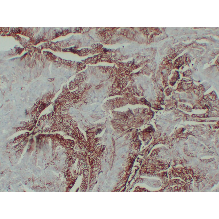 Immunohistochemistry - Anti-GLUT 1 Antibody (V0078) - Antibodies.com