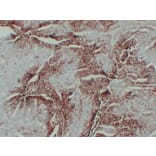 Immunohistochemistry - Anti-GLUT 1 Antibody (V0078) - Antibodies.com