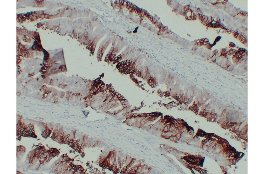 Immunohistochemistry - Anti-GLUT 1 Antibody (V0078) - Antibodies.com