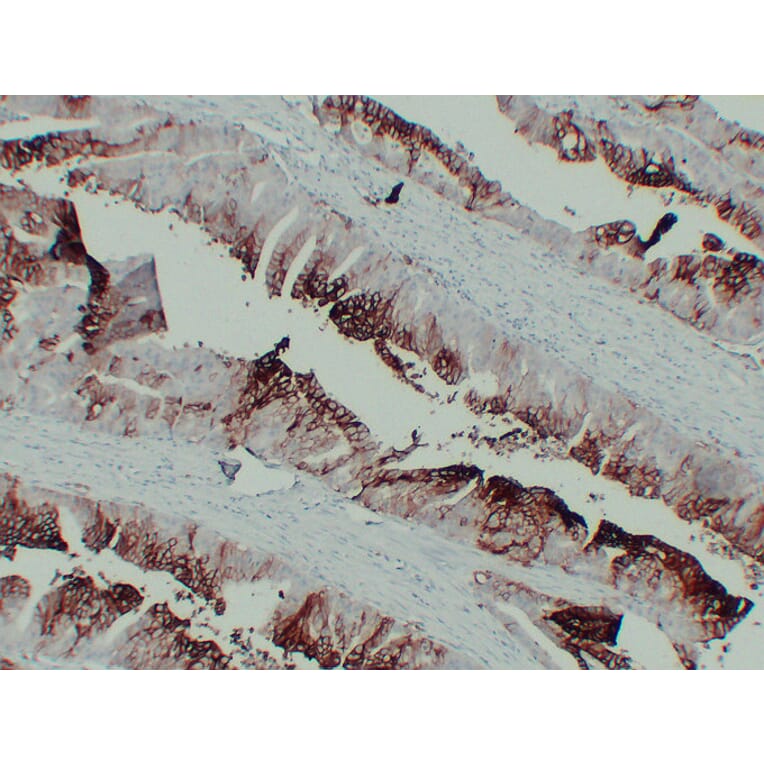 Immunohistochemistry - Anti-GLUT 1 Antibody (V0078) - Antibodies.com