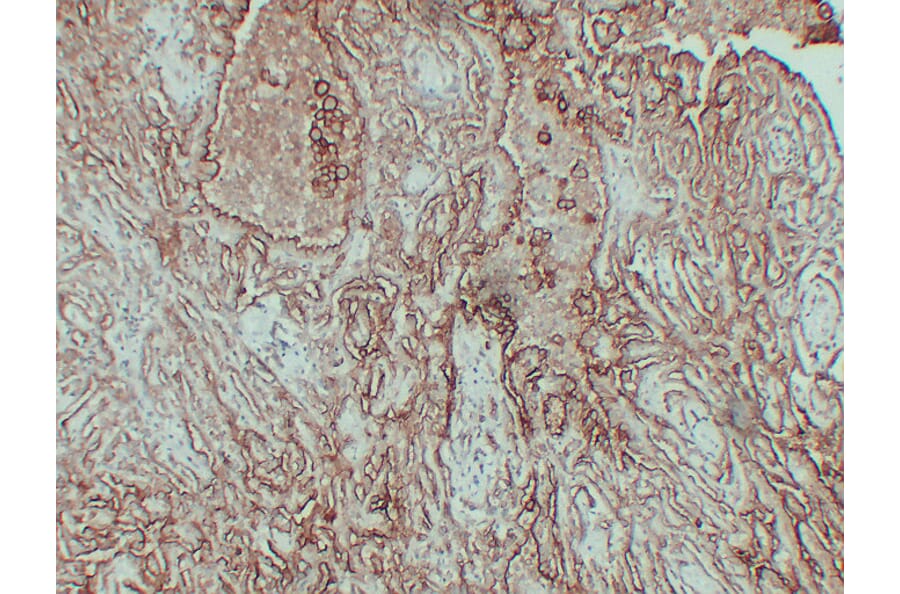 Immunohistochemistry - Anti-CA 125 Antibody (V0010) - Antibodies.com