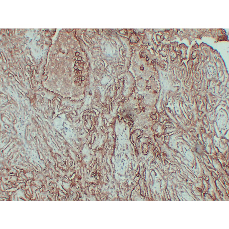 Immunohistochemistry - Anti-CA 125 Antibody (V0010) - Antibodies.com