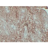 Immunohistochemistry - Anti-CA 125 Antibody (V0010) - Antibodies.com