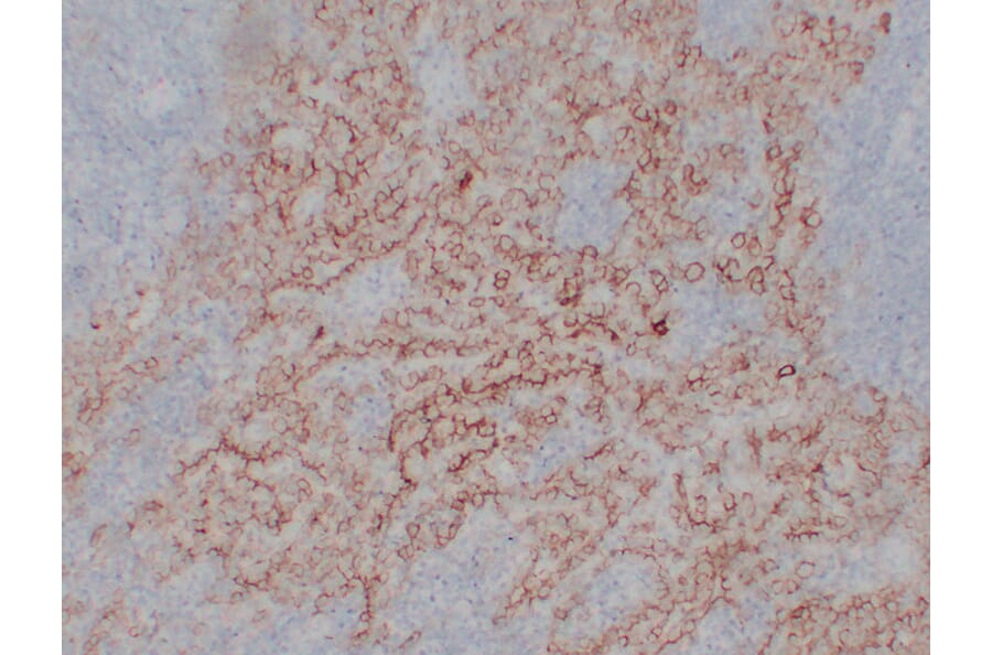 Immunohistochemistry - Anti-CA 125 Antibody (V0010) - Antibodies.com
