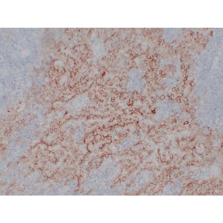 Immunohistochemistry - Anti-CA 125 Antibody (V0010) - Antibodies.com