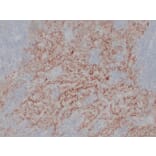Immunohistochemistry - Anti-CA 125 Antibody (V0010) - Antibodies.com
