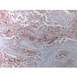 Immunohistochemistry - Anti-CA 125 Antibody (V0010) - Antibodies.com