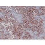 Immunohistochemistry - Anti-CA 125 Antibody (V0010) - Antibodies.com