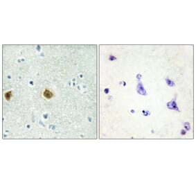 Immunohistochemistry - Anti-NDUC2 Antibody (C10222) - Antibodies.com