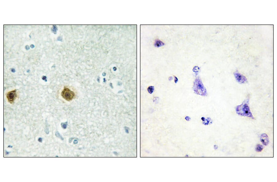 Immunohistochemistry - Anti-NDUC2 Antibody (C10222) - Antibodies.com