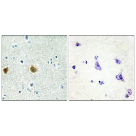 Immunohistochemistry - Anti-NDUC2 Antibody (C10222) - Antibodies.com