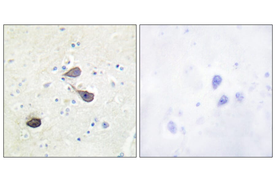 Immunohistochemistry - Anti-KOR-1 Antibody (B0448) - Antibodies.com