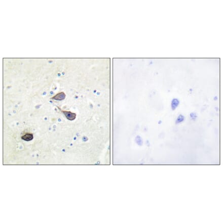 Immunohistochemistry - Anti-KOR-1 Antibody (B0448) - Antibodies.com