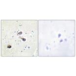 Immunohistochemistry - Anti-KOR-1 Antibody (B0448) - Antibodies.com