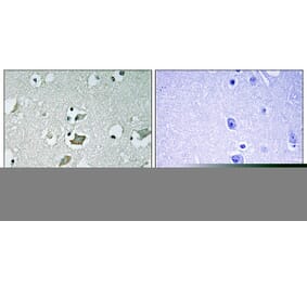Immunohistochemistry - Anti-KCNJ2 Antibody (C16400) - Antibodies.com