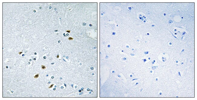 Immunohistochemical analysis of paraffin-embedded human brain tissue using Anti-BRCA2 Antibody. The right hand panel represents a negative control, where the antibody was pre-incubated with the immunising peptide.