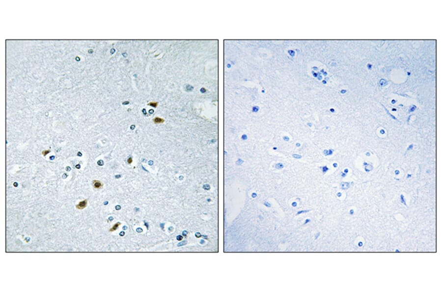 Immunohistochemistry - Anti-BRCA2 Antibody (C10682) - Antibodies.com