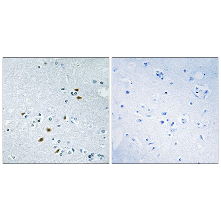 Immunohistochemistry - Anti-BRCA2 Antibody (C10682) - Antibodies.com