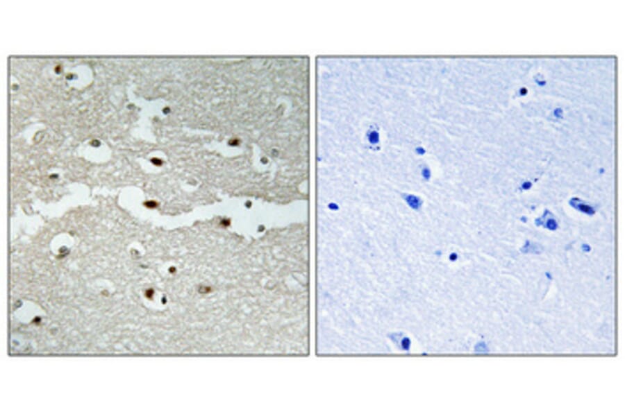 Immunohistochemistry - Anti-BRCA2 Antibody (C10682) - Antibodies.com