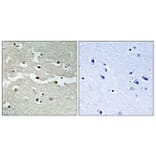 Immunohistochemistry - Anti-BRCA2 Antibody (C10682) - Antibodies.com