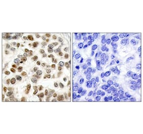 Immunohistochemistry - Anti-BRCA1 Antibody (B7030) - Antibodies.com