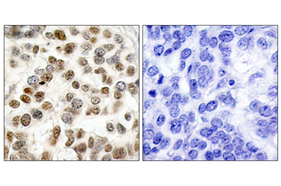 Immunohistochemistry - Anti-BRCA1 Antibody (B7030) - Antibodies.com