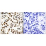 Immunohistochemistry - Anti-BRCA1 Antibody (B7030) - Antibodies.com