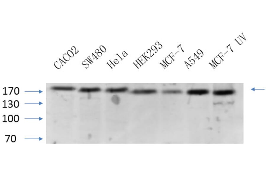 Western Blot - Anti-BRCA1 Antibody (B7030) - Antibodies.com