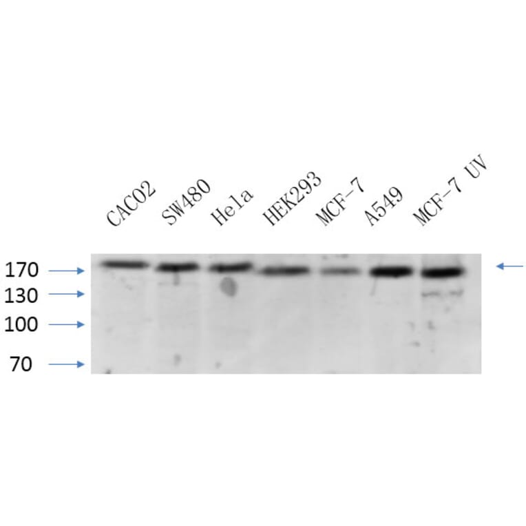 Western Blot - Anti-BRCA1 Antibody (B7030) - Antibodies.com