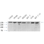 Western Blot - Anti-BRCA1 Antibody (B7030) - Antibodies.com