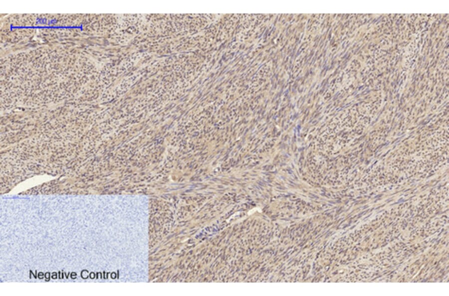 Immunohistochemistry - Anti-BRCA1 Antibody (B7030) - Antibodies.com